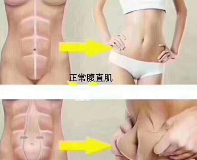 产后多久可以跑步健身不影响母乳图7