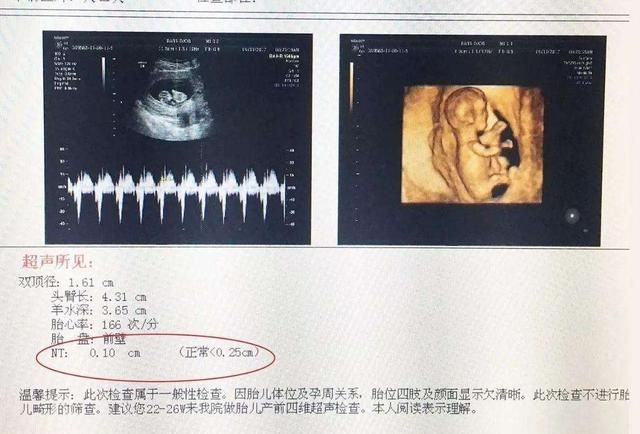 怀孕后什么时间检查什么项目图3