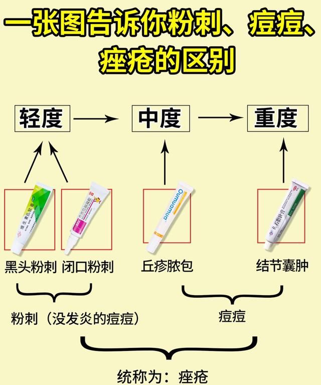 祛痘用什么牌子的产品最好图1