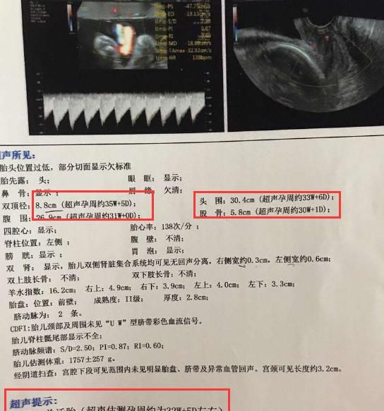 第一次生孩子会在预产期前还是后图6